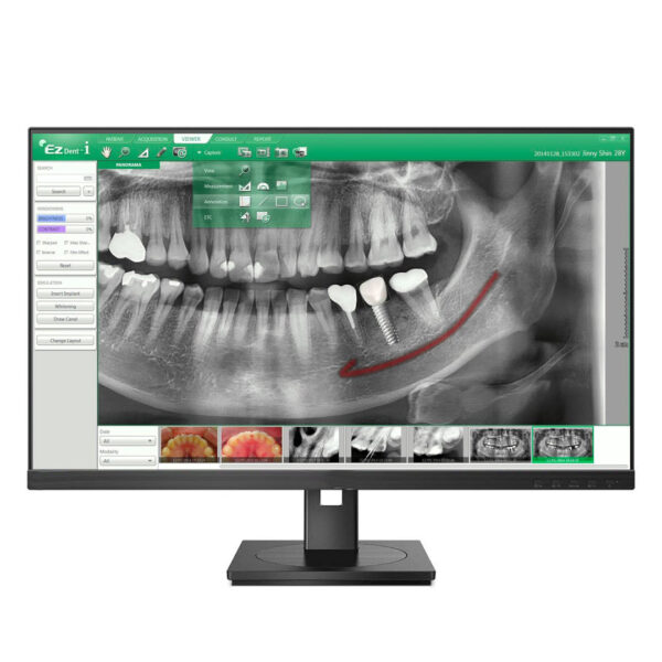 Vatech Software EzDent-i 2D Viewer for all Vatech Systems Vatech Software EzDent-i 2D Viewer for all Vatech Systems