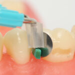 TDV Unimatrix Sectional Matrix Bands Medium (100)