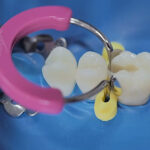TDV Unimatrix R Sectional Matrix Ring Soft Pink (1)
