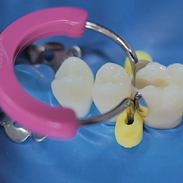 TDV Unimatrix R Sectional Matrix Ring Soft Pink (1)