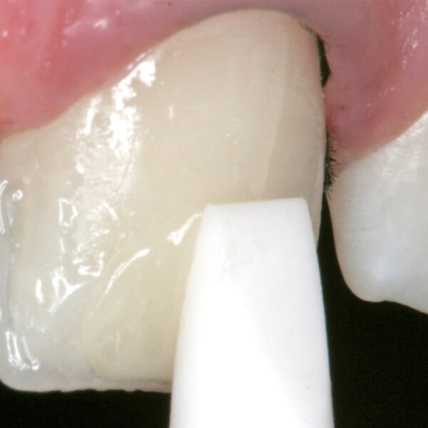 TDV Esthetic Plus Instrument (2)