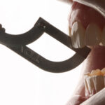 TDV Microcut Interdental Saw